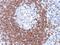 CD79a antibody, GTX34555, GeneTex, Immunohistochemistry paraffin image 