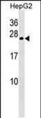 Crystallin Gamma B antibody, PA5-48740, Invitrogen Antibodies, Western Blot image 