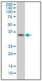 Sprouty RTK Signaling Antagonist 1 antibody, AM31089PU-N, Origene, Western Blot image 