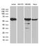 Protein Phosphatase 2 Scaffold Subunit Abeta antibody, MA5-27460, Invitrogen Antibodies, Western Blot image 