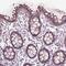 Trichoplein Keratin Filament Binding antibody, HPA061543, Atlas Antibodies, Immunohistochemistry paraffin image 