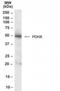 Pyruvate Dehydrogenase Complex Component X antibody, NB100-1496, Novus Biologicals, Western Blot image 