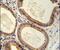 Translocation Associated Membrane Protein 2 antibody, PA5-25887, Invitrogen Antibodies, Immunohistochemistry paraffin image 