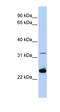 Proteolipid Protein 1 antibody, orb324496, Biorbyt, Western Blot image 