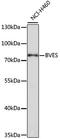 Blood Vessel Epicardial Substance antibody, A0213, ABclonal Technology, Western Blot image 