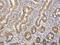 Rho Associated Coiled-Coil Containing Protein Kinase 2 antibody, H00009475-M02, Novus Biologicals, Immunohistochemistry frozen image 