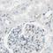 Calcium Voltage-Gated Channel Auxiliary Subunit Alpha2delta 1 antibody, NBP1-86682, Novus Biologicals, Immunohistochemistry paraffin image 