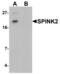 Serine Peptidase Inhibitor, Kazal Type 2 antibody, LS-B9594, Lifespan Biosciences, Western Blot image 