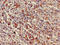 USP6 N-Terminal Like antibody, LS-C679966, Lifespan Biosciences, Immunohistochemistry paraffin image 