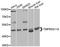 Transmembrane Serine Protease 11A antibody, orb374218, Biorbyt, Western Blot image 