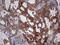 Pyruvate Kinase M1/2 antibody, LS-C337113, Lifespan Biosciences, Immunohistochemistry paraffin image 