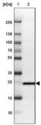 TPD52 Like 1 antibody, NBP1-84314, Novus Biologicals, Western Blot image 