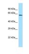 Sosondowah Ankyrin Repeat Domain Family Member C antibody, orb326653, Biorbyt, Western Blot image 