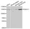 F-Box Protein 11 antibody, LS-C334529, Lifespan Biosciences, Western Blot image 