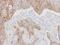 Basigin (Ok Blood Group) antibody, PA5-27296, Invitrogen Antibodies, Immunohistochemistry paraffin image 