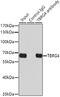 Transforming Growth Factor Beta Regulator 4 antibody, GTX55813, GeneTex, Immunoprecipitation image 