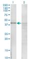 NFKB Inhibitor Beta antibody, H00004793-M06, Novus Biologicals, Western Blot image 