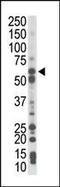 Phosphoenolpyruvate Carboxykinase 1 antibody, PA5-15364, Invitrogen Antibodies, Western Blot image 