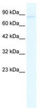 Glutamate Ionotropic Receptor Kainate Type Subunit 2 antibody, TA338702, Origene, Western Blot image 