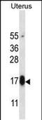 Glycoprotein Hormone Subunit Beta 5 antibody, PA5-48537, Invitrogen Antibodies, Western Blot image 