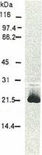 HCV Core Protein antibody, 65-051, BioAcademia Inc, Western Blot image 