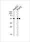 Aldehyde Dehydrogenase 1 Family Member A1 antibody, LS-C156252, Lifespan Biosciences, Western Blot image 