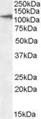 C-Type Lectin Domain Containing 16A antibody, LS-C112721, Lifespan Biosciences, Western Blot image 