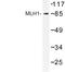 MutL Homolog 1 antibody, LS-C176980, Lifespan Biosciences, Western Blot image 