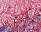 Glutamate Dehydrogenase 2 antibody, LS-B15236, Lifespan Biosciences, Immunohistochemistry paraffin image 