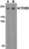 Adhesion G Protein-Coupled Receptor A2 antibody, TA306489, Origene, Western Blot image 