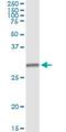 HLA class II histocompatibility antigen, DM beta chain antibody, H00003109-M07, Novus Biologicals, Immunoprecipitation image 