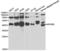 NFKB Inhibitor Beta antibody, LS-C334284, Lifespan Biosciences, Western Blot image 