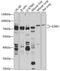 Interleukin 5 Receptor Subunit Alpha antibody, GTX64632, GeneTex, Western Blot image 