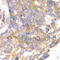 Calpain Small Subunit 1 antibody, A6539, ABclonal Technology, Immunohistochemistry paraffin image 