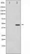 Jun Proto-Oncogene, AP-1 Transcription Factor Subunit antibody, TA325594, Origene, Western Blot image 