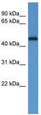 Ligand Dependent Nuclear Receptor Corepressor antibody, TA342759, Origene, Western Blot image 