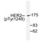 ERBB2 antibody, AP01602PU-N, Origene, Western Blot image 