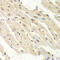 Proteasome Activator Subunit 1 antibody, LS-C334008, Lifespan Biosciences, Immunohistochemistry frozen image 