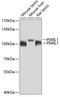 Piwi Like RNA-Mediated Gene Silencing 1 antibody, GTX54631, GeneTex, Western Blot image 