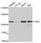 ACK1 antibody, TA332541, Origene, Western Blot image 