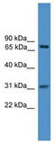 Zinc Finger Protein 471 antibody, TA345298, Origene, Western Blot image 