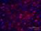 POU Class 5 Homeobox 1 antibody, ab18976, Abcam, Immunohistochemistry paraffin image 