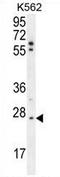 Tumor necrosis factor alpha-induced protein 8 antibody, AP54304PU-N, Origene, Western Blot image 