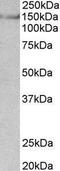 Transglutaminase 2 antibody, 42-882, ProSci, Western Blot image 