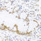 p53 antibody, 18-984, ProSci, Immunofluorescence image 