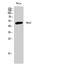 MAP kinase-interacting serine/threonine-protein kinase 2 antibody, STJ94173, St John