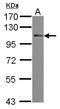 Phospholipase A2 Group IVA antibody, NBP2-19809, Novus Biologicals, Western Blot image 