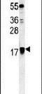 ADP Ribosylation Factor 1 antibody, PA5-25765, Invitrogen Antibodies, Western Blot image 