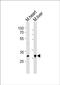 Homeobox B1 antibody, PA5-72217, Invitrogen Antibodies, Western Blot image 