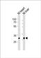 Homeobox B1 antibody, PA5-72217, Invitrogen Antibodies, Western Blot image 